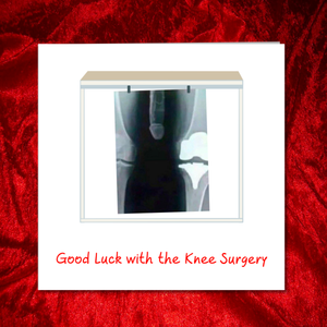 funny knee operation card