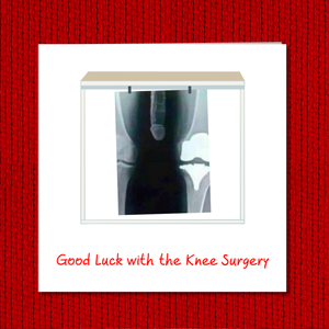 humorous knee operation card